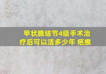 甲状腺结节4级手术治疗后可以活多少年 疤痕